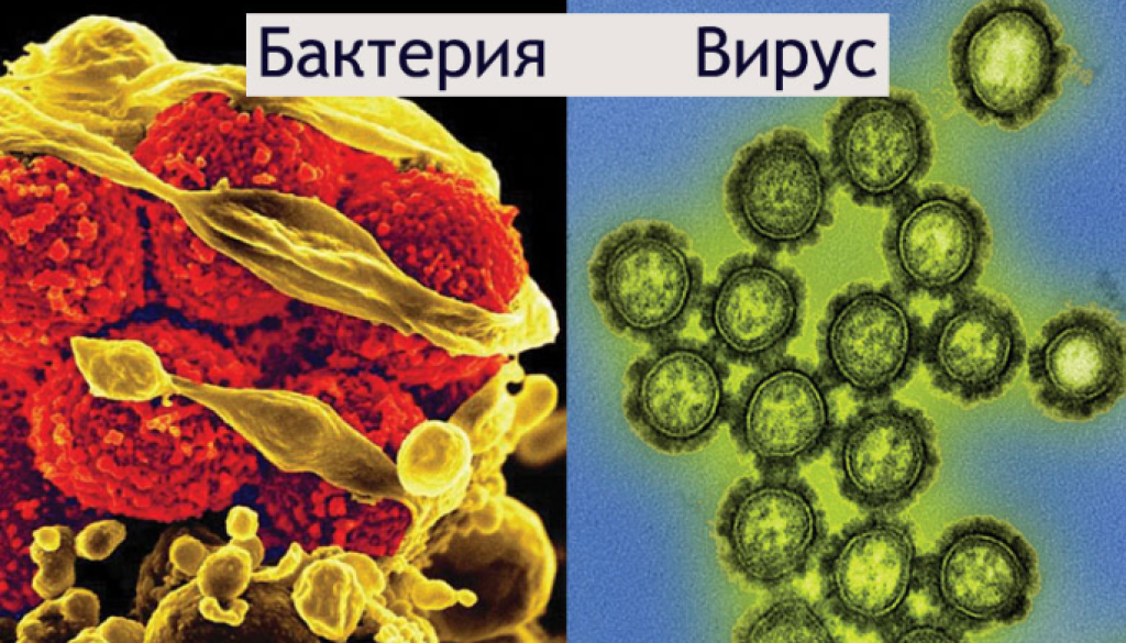 вирусите и бактерии